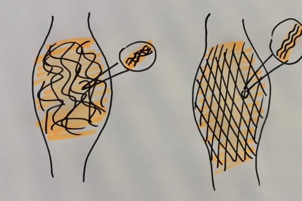 Tik am Tibarg > Titelbild > Faszien > Hack > 1000x400