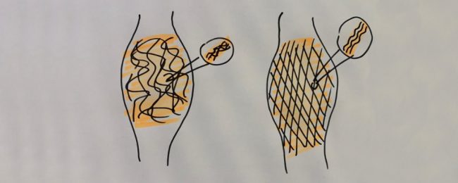 tik_FaszienHack-Blog_Titelbild Tik am Tibarg > Titelbild > Faszien > Hack > 1000x400